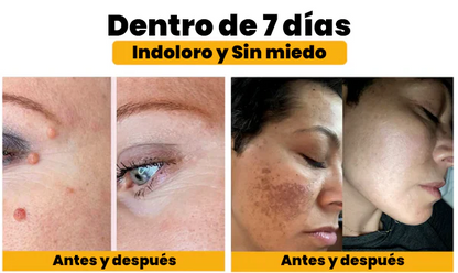 🐝 Bee Venom | Treatment Cream 🐝 (120 Gramos)